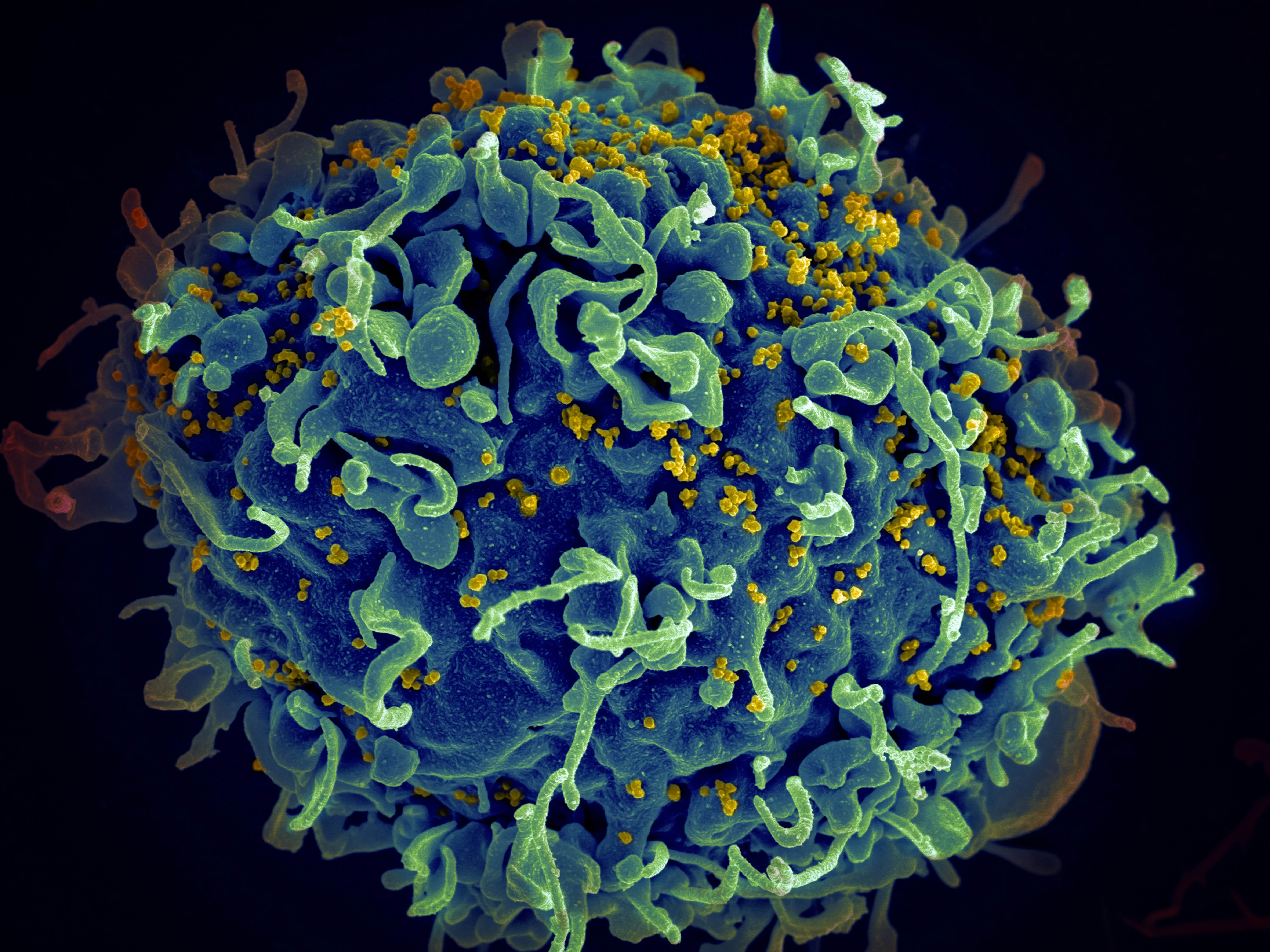 How Is Breast Cancer Usually Detected?