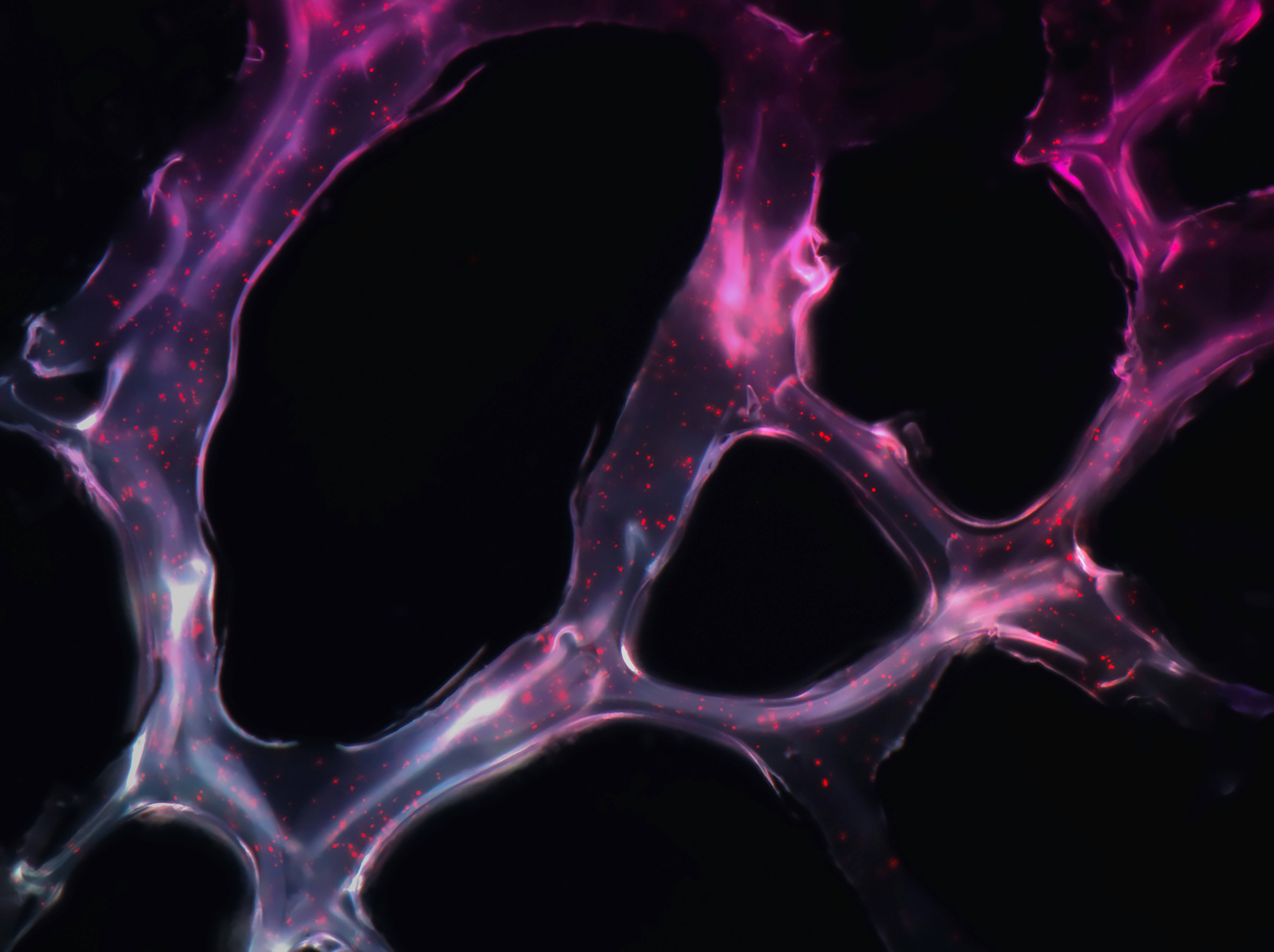 How Safe Is Breast Cancer Screening?